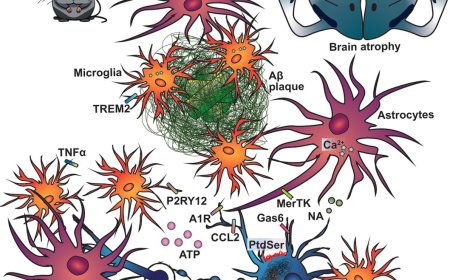 How sleep protects against neurodegeneration