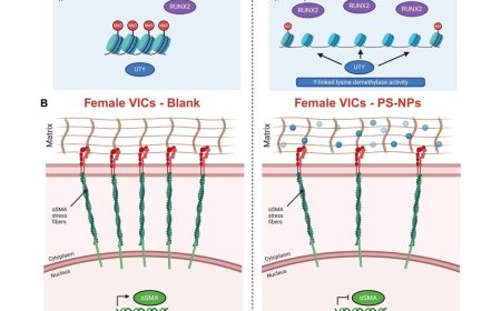 How a Y chromosome gene may shape the course of heart valve disease