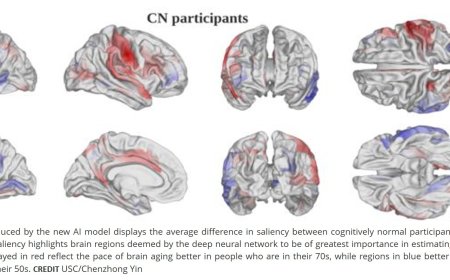 Deep learning to quantify the pace of brain aging