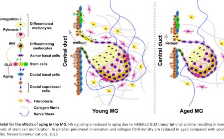 Mechanisms of aging in Meibomian gland