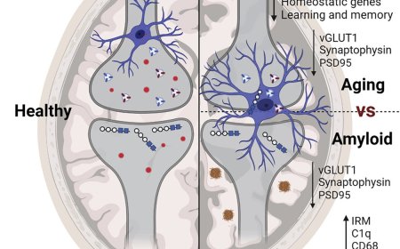C9ORF72 gene in Alzheimer’s disease