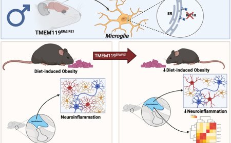 How microglial ER Stress may lead to obesity