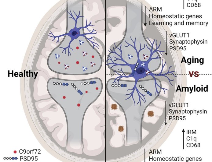 C9ORF72 gene in Alzheimer’s disease