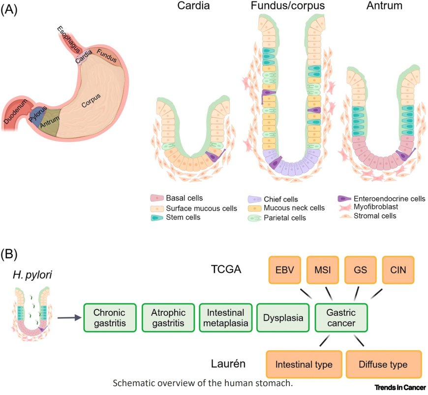 Gastric pathophysiology in gastric cancer