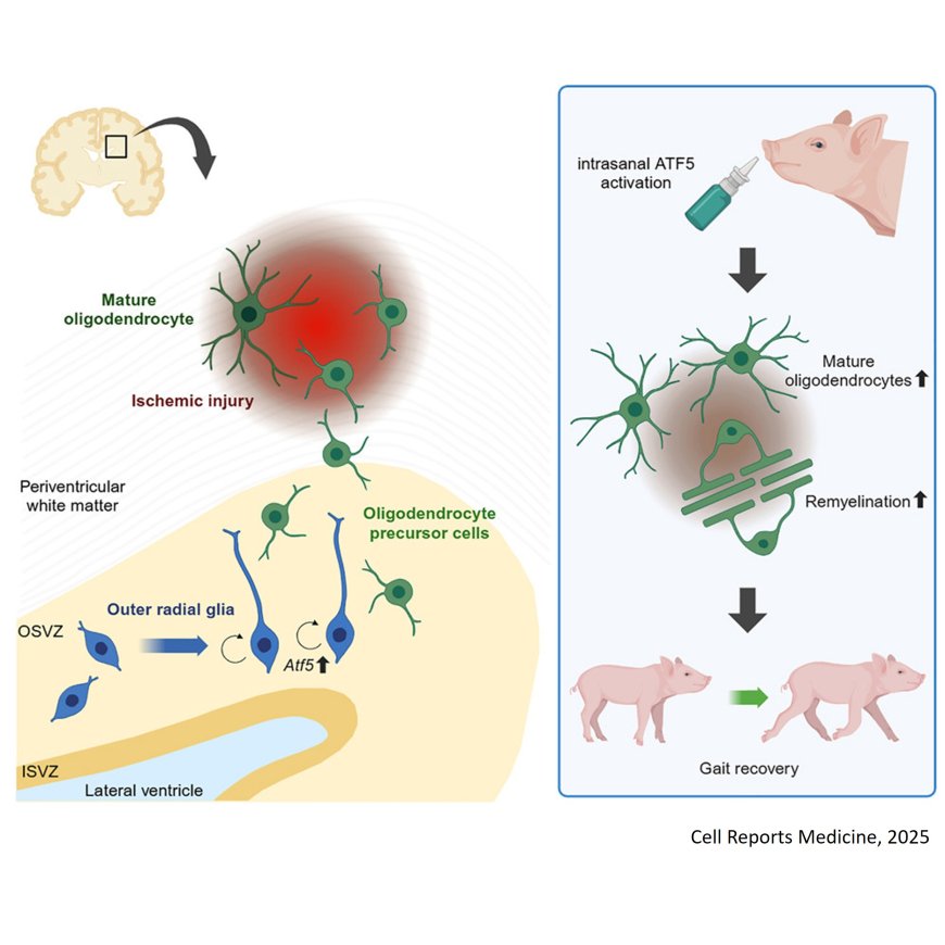 Outer radial glia promotes white matter regeneration after neonatal brain injury