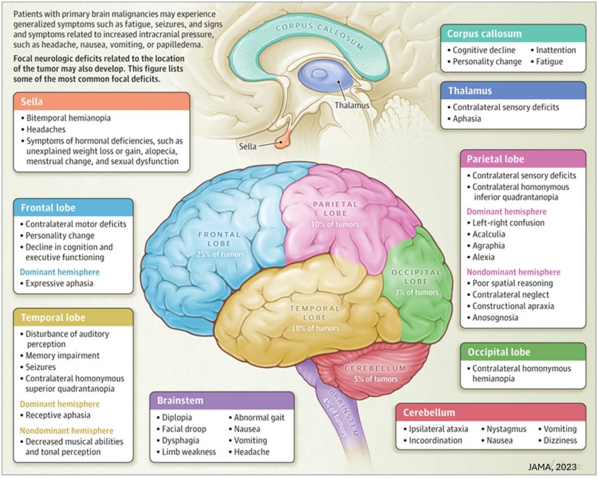 Glioblastoma and Other Primary Brain Malignancies in Adults