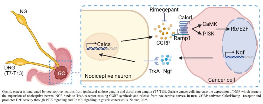 Nociceptive neurons promote gastric tumor progression