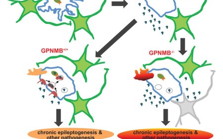 How microglia facilitate phagocytosis of multiple types of pathological particles