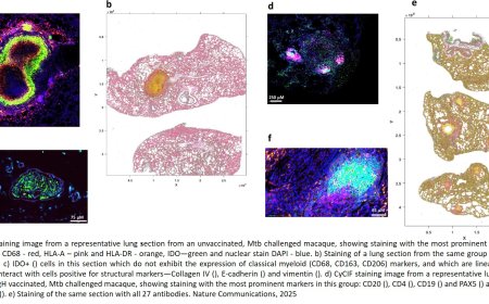 Attenuated Mycobacterium tuberculosis vaccine candidate to prevent tuberculosis