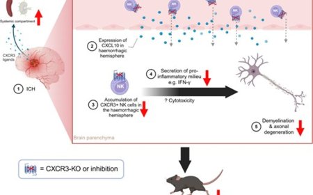 Role of CXCR3-mediated natural killer cell infiltration in intracerebral haemorrhage