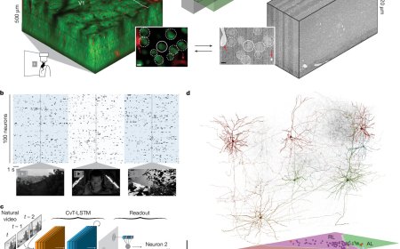 AI models of the brain could serve as ‘digital twins’ in research