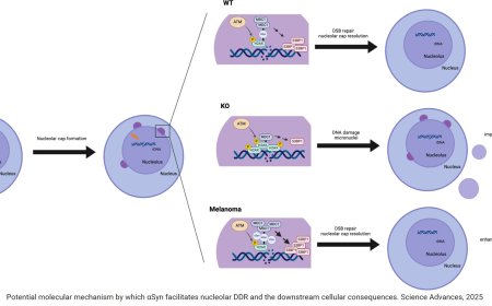 Parkinson’s disease protein drives skin cancer
