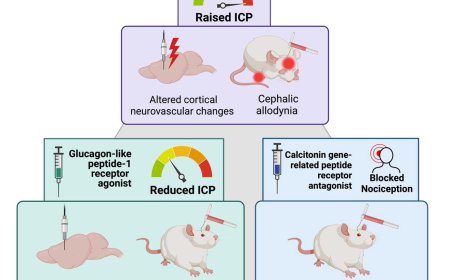 Reducing cephalic pain in raised intracranial pressure