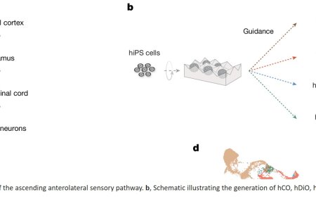 Human assembloid model of the ascending neural sensory pathway