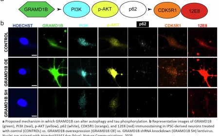 Link between lipid dyshomeostasis and tau pathology in neurodegeneration