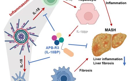 Treatment of IL-18-binding protein biologics to treat liver disease
