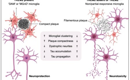TREM2 and sTREM2 in Alzheimer’s disease