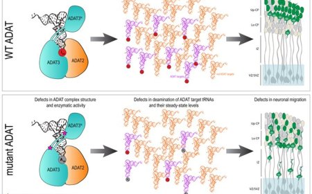 ADAT3 variants impair neuronal migration
