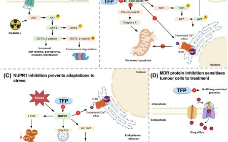 Glioblastoma treatment using repurposed trifluoperazine