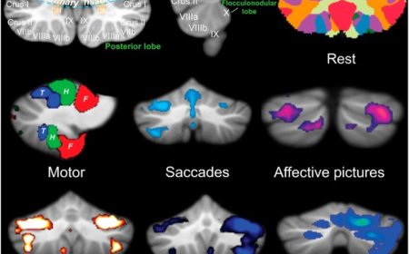 Cerebellum is important for brain function and can’t be ignored!