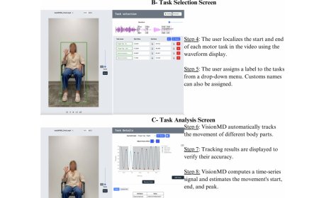 AI tool to better assess Parkinson’s disease, other movement disorders