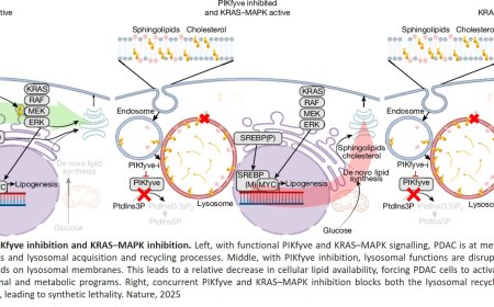 Targeting PIKfyve-driven lipid metabolism in pancreatic cancer