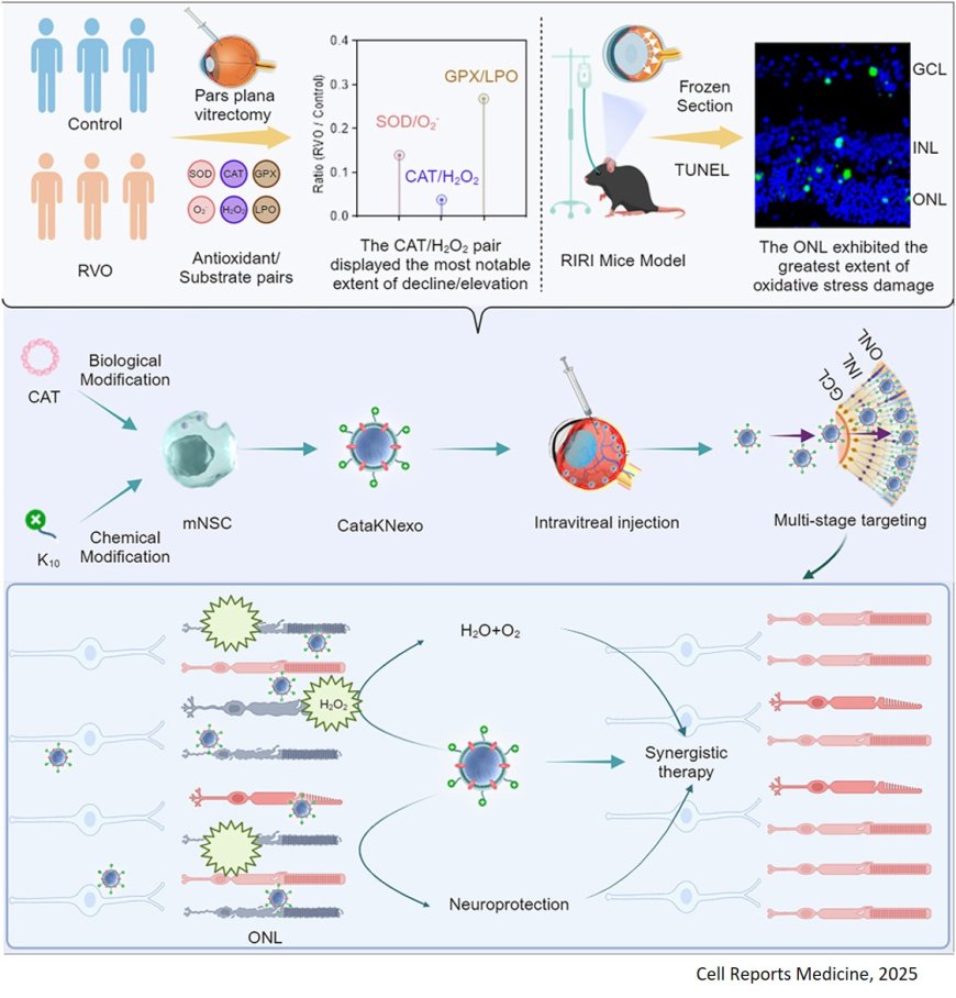 Catalytic neural stem cell exosomes for multi-stage targeting and synergistical therapy of retinal ischemia-reperfusion injury