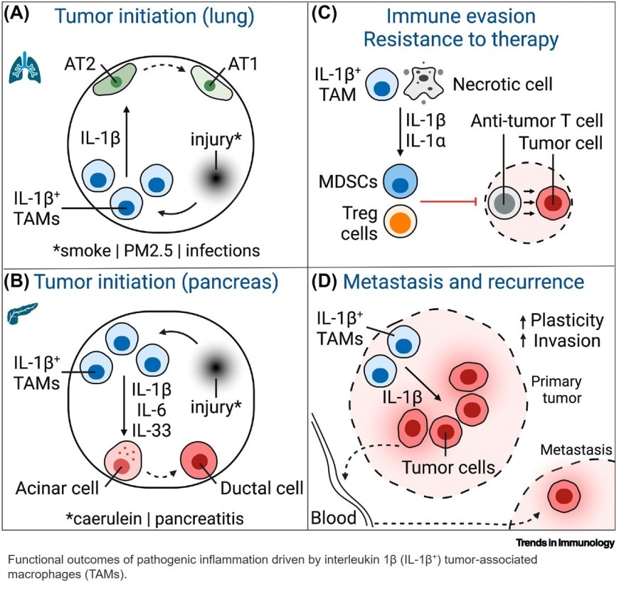 IL-1β+ macrophages and the control of pathogenic inflammation in cancer