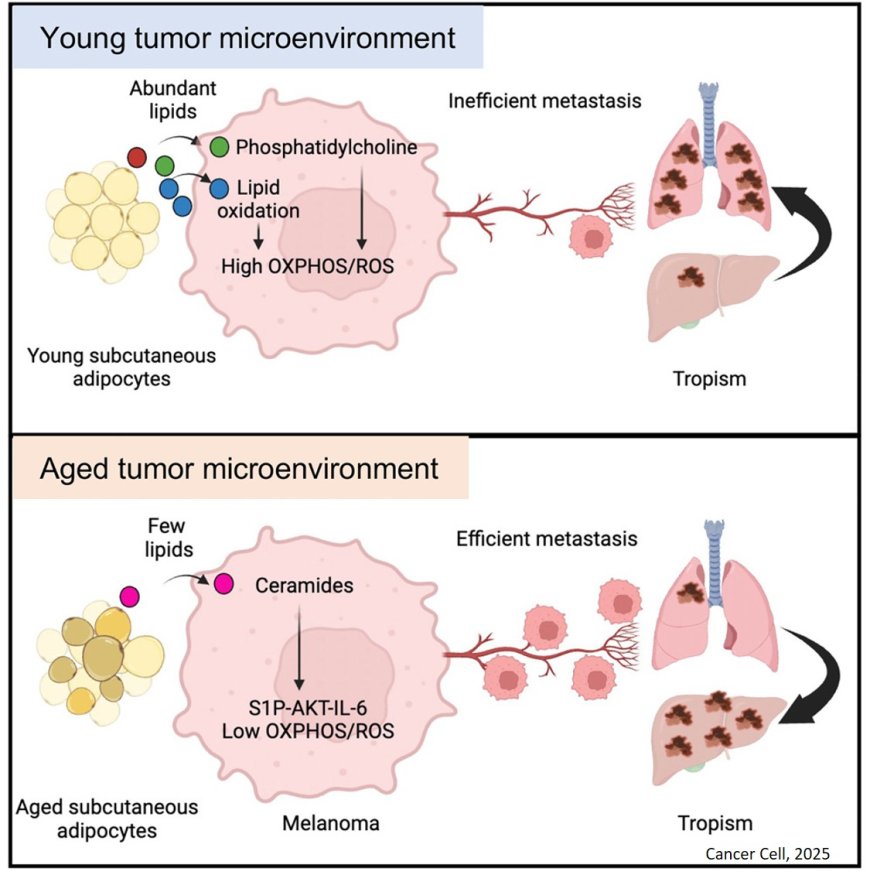 Stromal lipid species dictate melanoma metastasis and tropism