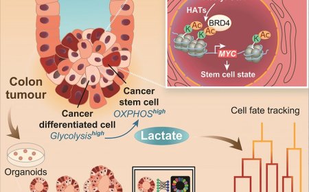 Role of lactate in cancer dynamics