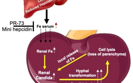 Hepcidin in essential for host resistance to Candida albicans
