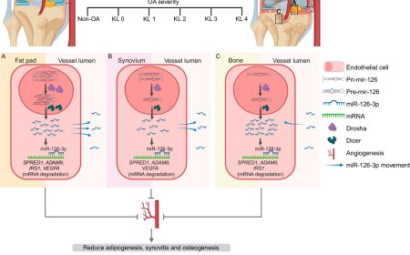 Circulating miR-126-3p is a biomarker for knee osteoarthritis