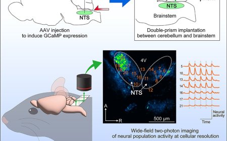 Minimally invasive, wide-field two-photon imaging of the brainstem at cellular resolution
