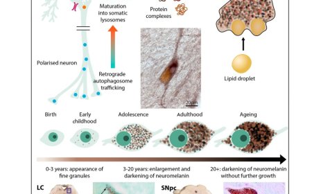 Neuromelanin and  Parkinson’s disease