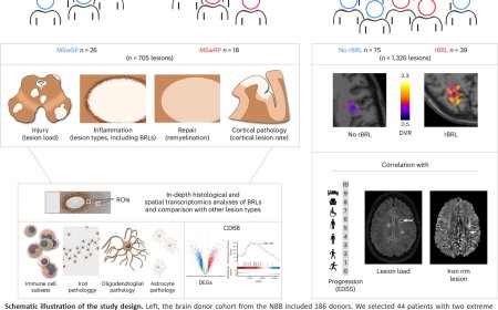 Predicting progression of multiple sclerosis