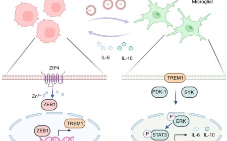 Zinc-transporting protein contributes to aggressive growth of brain tumor
