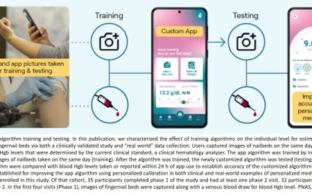 AI-powered app enables anemia screening using fingernail selfies
