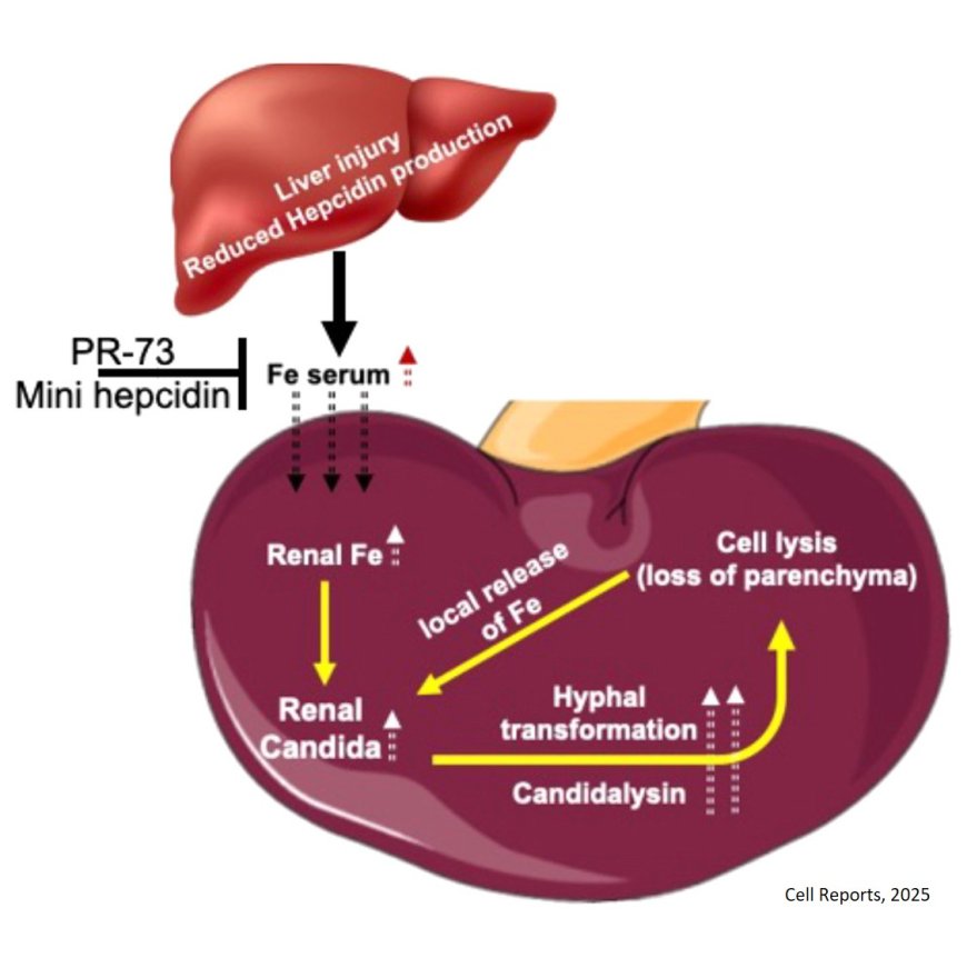 Essential role of hepcidin in host resistance to disseminated candidiasis