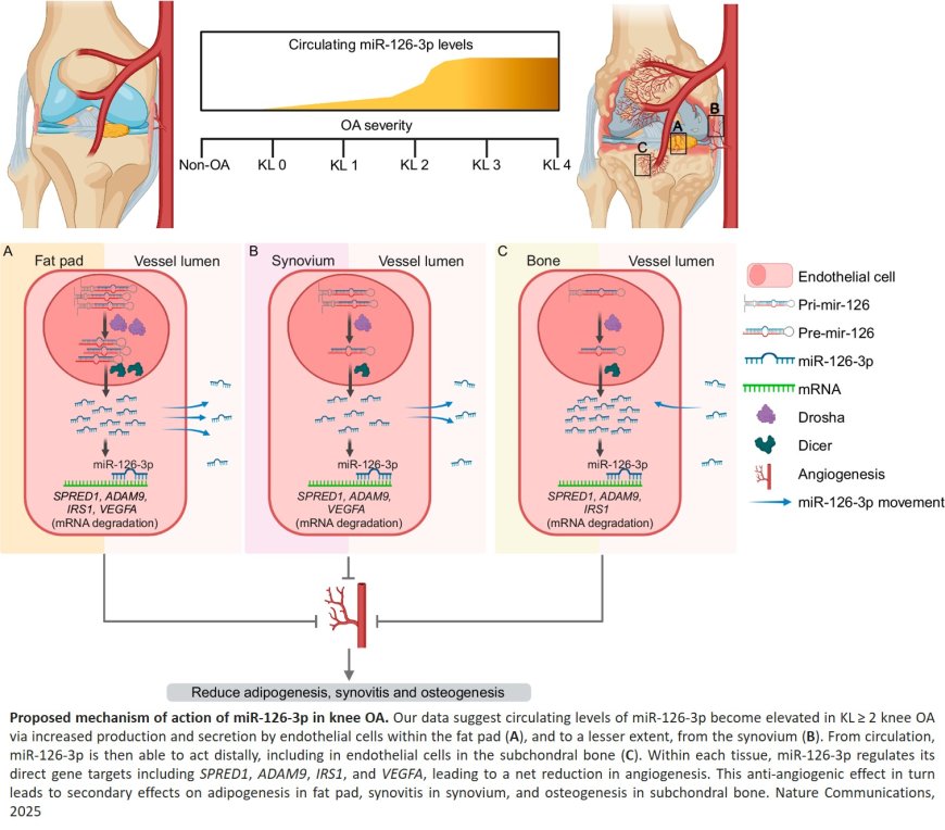 Circulating miR-126-3p is a biomarker for knee osteoarthritis