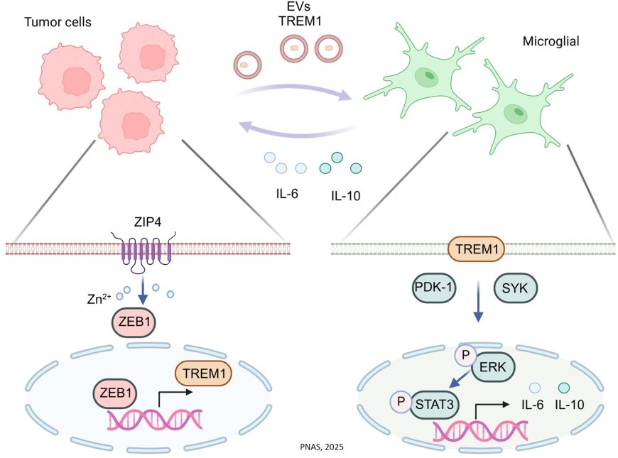 Zinc-transporting protein contributes to aggressive growth of brain tumor
