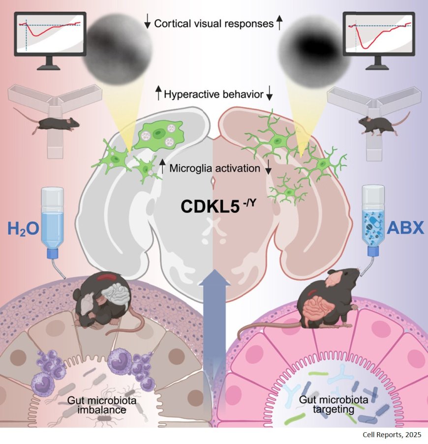 Targeting gut microbiota in CDKL5 deficiency disorder