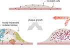 Similarities between atherosclerotic blood vessels and tumor development