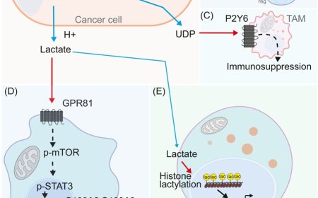 Tumor–stromal metabolic crosstalk in pancreatic cancer