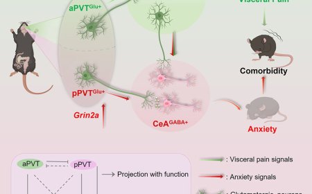 How paraventricular thalamus mediates visceral pain and anxiety-like behaviors