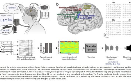 Neuroprosthesis for instantaneous voice-synthesis