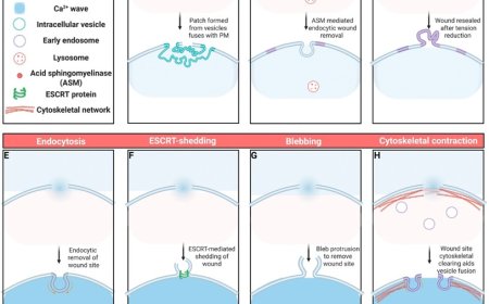 Time matters: the dynamics of plasma membrane repair