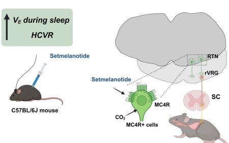 A potential treatment for obesity-linked breathing disorder