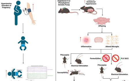 High blood pressure in pregnancy linked to increased risk of seizure in children