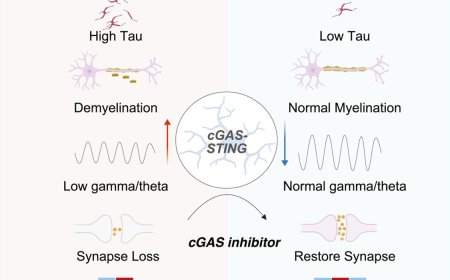 Alzheimer’s protective mutation works by taming inflammation in the brain