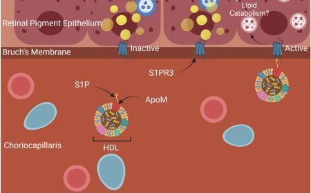 Fixing cholesterol metabolism problem to prevent blindness